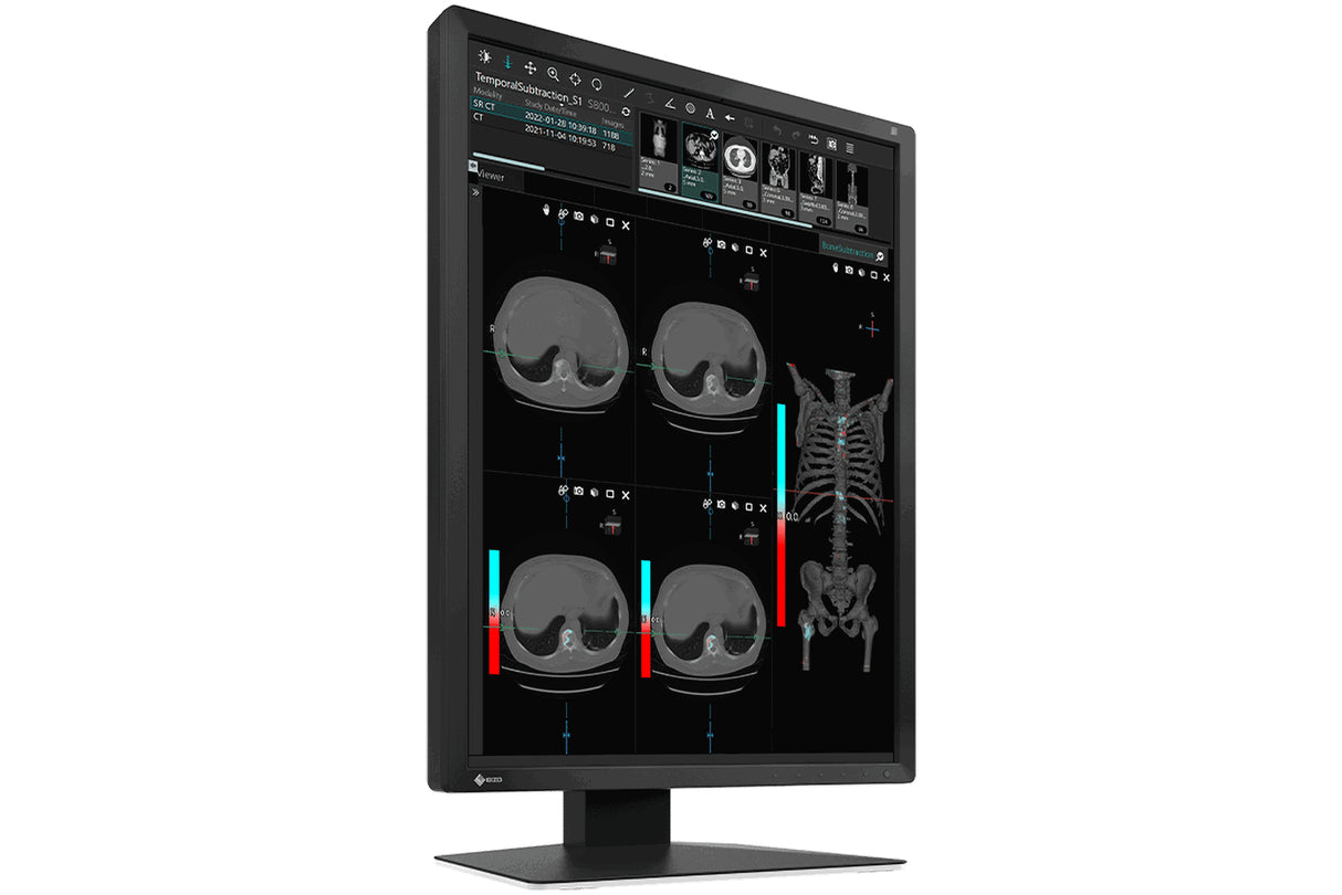EIZO RadiForce MX217-BK computer monitor 54.1 cm (21.3") 1200 x 1600 pixels LCD Black