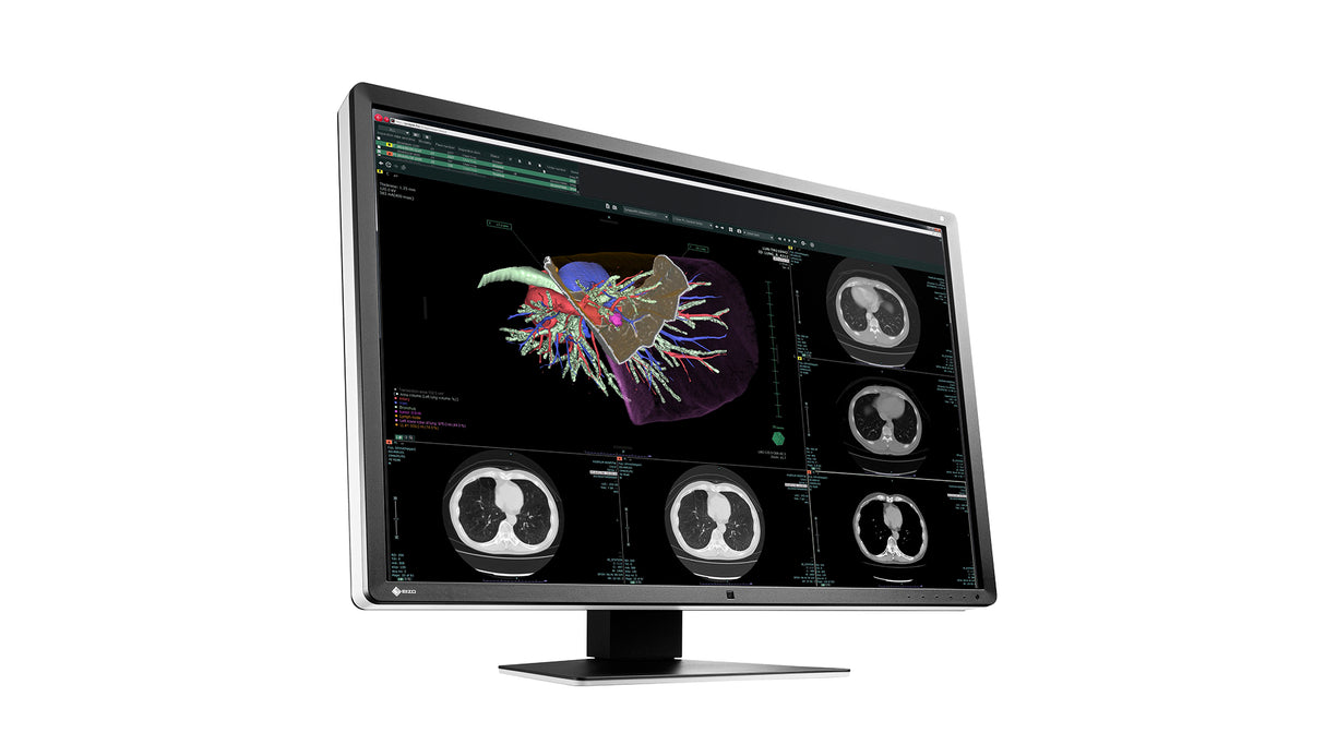 EIZO RadiForce RX660 computer monitor 76.2 cm (30") 3280 x 2048 pixels WQSXGA LED Black, White