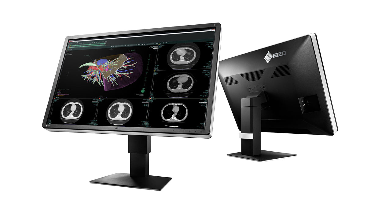 EIZO RadiForce RX660 computer monitor 76.2 cm (30") 3280 x 2048 pixels WQSXGA LED Black, White