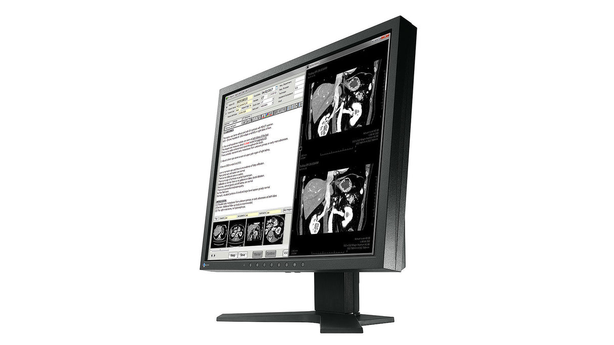 EIZO RadiForce MX194 computer monitor 48.3 cm (19") 1280 x 1024 pixels LCD Black