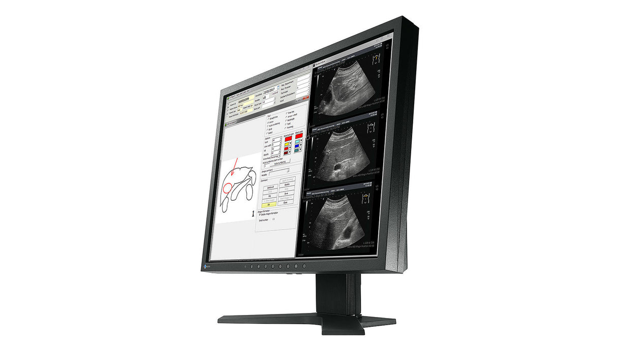 EIZO RadiForce MX194 computer monitor 48.3 cm (19") 1280 x 1024 pixels LCD Black
