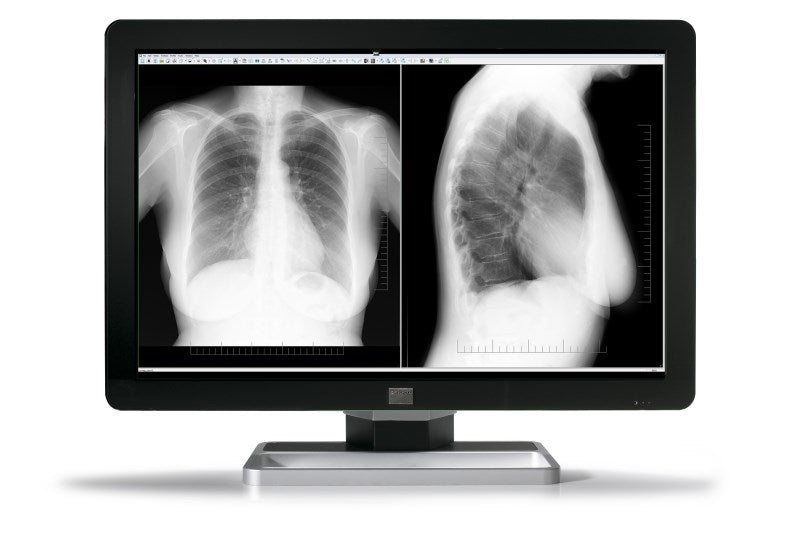 Barco MDCC-6430 computer monitor 77.2 cm (30.4") 3280 x 2048 pixels 4K Ultra HD LCD Black, Silver
