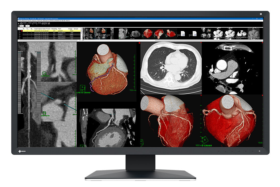 EIZO RadiForce MX317W computer monitor 77.5 cm (30.5") 4096 x 2160 pixels 4K DCI LCD Black