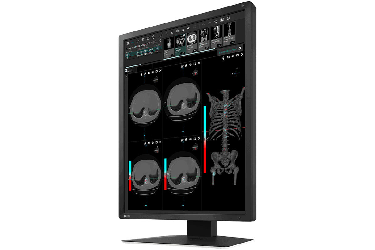EIZO RadiForce MX217-BK computer monitor 54.1 cm (21.3") 1200 x 1600 pixels LCD Black