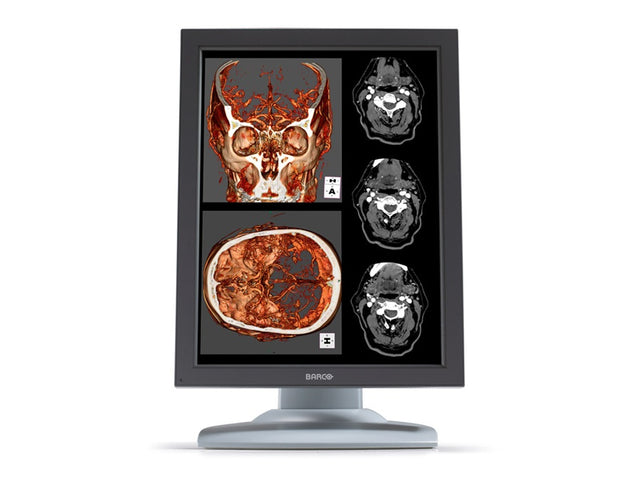 Barco MDNC-2121 computer monitor 54.1 cm (21.3") 1600 x 1200 pixels LED Grey