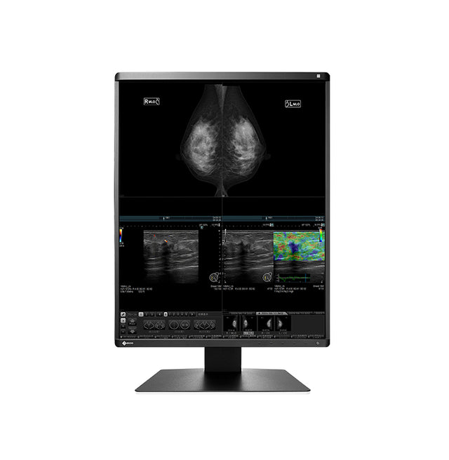 EIZO RadiForce RX570-BK computer monitor 54.1 cm (21.3") 2048 x 2560 pixels LCD Black