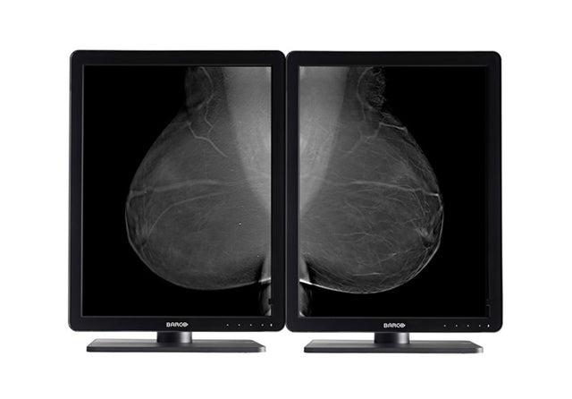 Barco Nio 5MP LED (MDNG-5221) computer monitor 54.1 cm (21.3") 2560 x 2048 pixels 2K Ultra HD Black, White