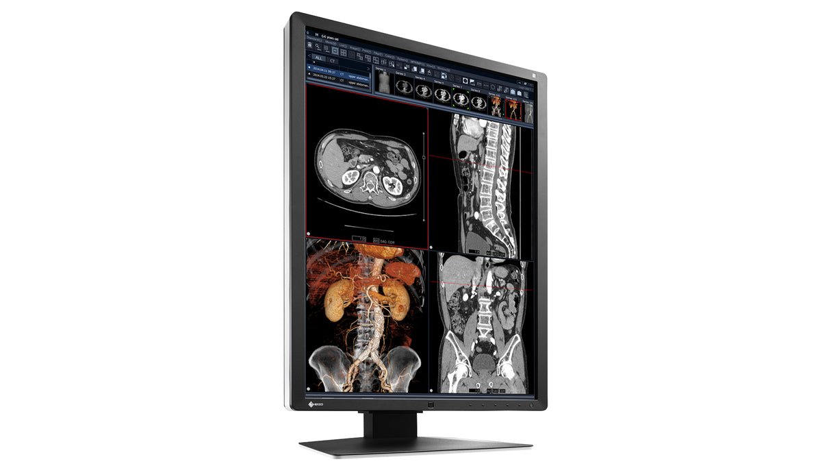 EIZO RadiForce RX250 computer monitor 54.1 cm (21.3") 1200 x 1600 pixels LCD Black