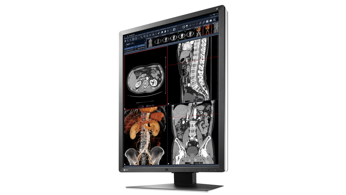 EIZO RadiForce RX250 computer monitor 54.1 cm (21.3") 1200 x 1600 pixels LCD Black