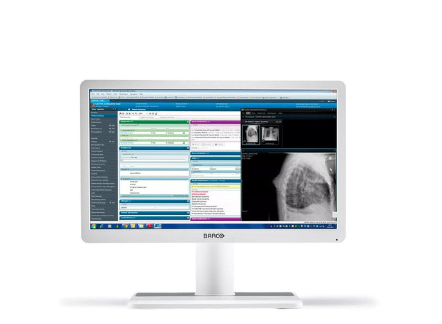 Barco MDRC‑2222 computer monitor 54.6 cm (21.5") 1920 x 1080 pixels Full HD LCD White