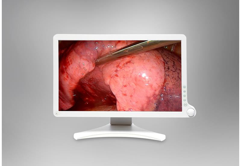 Barco AMM 215WTD computer monitor 54.4 cm (21.4") 1920 x 1080 pixels Full HD LCD White