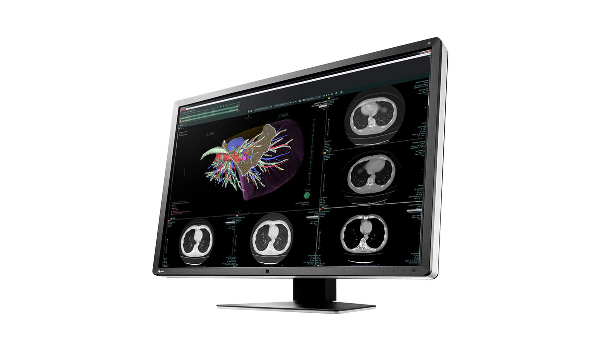 EIZO RadiForce RX660 computer monitor 76.2 cm (30") 3280 x 2048 pixels WQSXGA LED Black, White