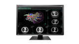 EIZO RadiForce RX660 computer monitor 76.2 cm (30") 3280 x 2048 pixels WQSXGA LED Black, White