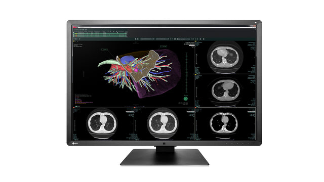 EIZO RadiForce RX660 computer monitor 76.2 cm (30") 3280 x 2048 pixels WQSXGA LED Black, White