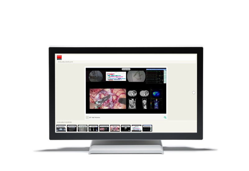Barco 215ETTWZE computer monitor 54.5 cm (21.5") 1920 x 1080 pixels Full HD LCD Touchscreen Black