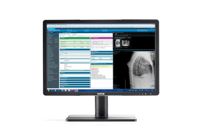 Barco MDRC‑2222 Option BL computer monitor 54.6 cm (21.5") 1920 x 1080 pixels Full HD LCD Black