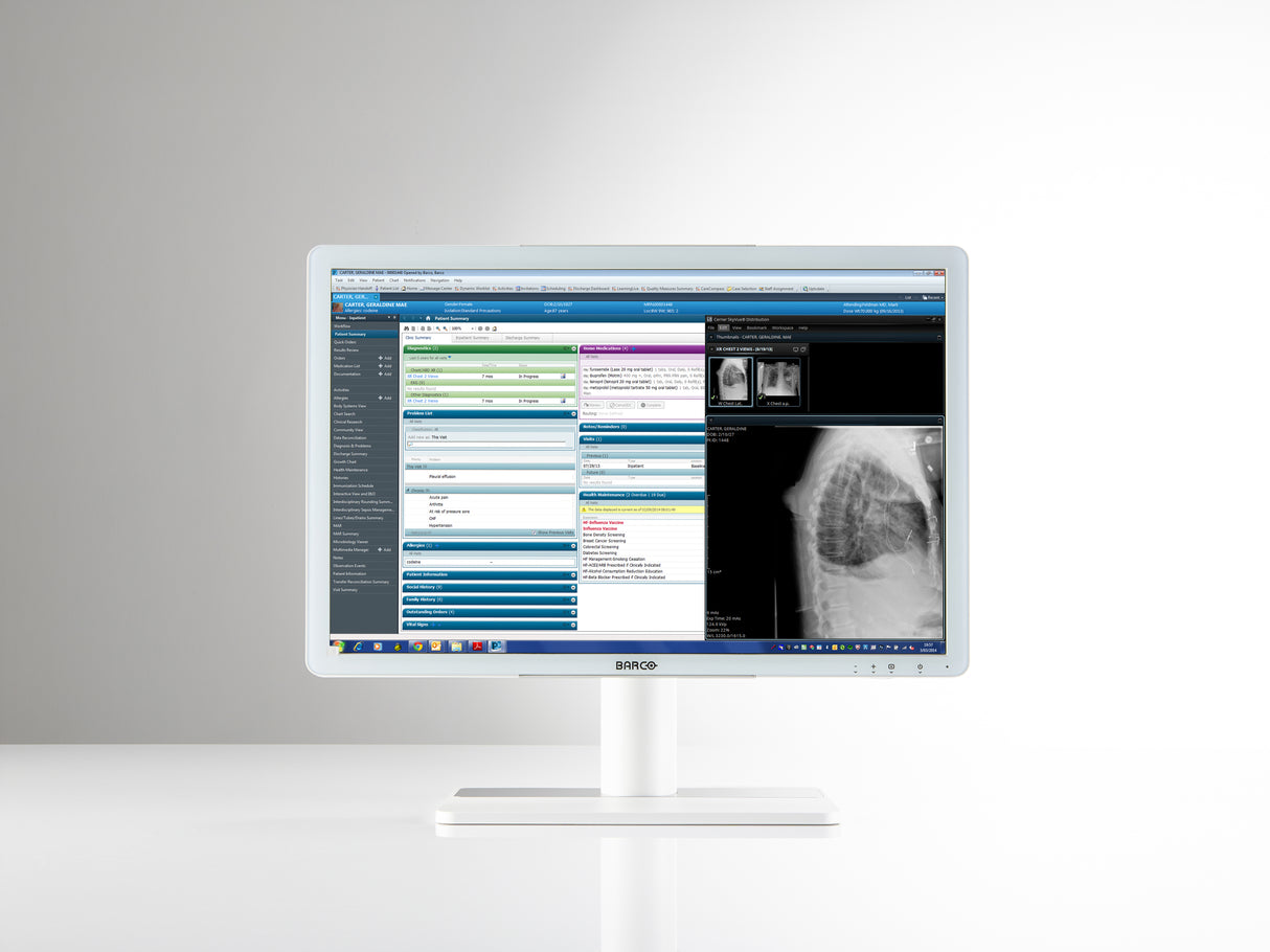 Barco MDRC‑2222 computer monitor 54.6 cm (21.5") 1920 x 1080 pixels Full HD LCD White