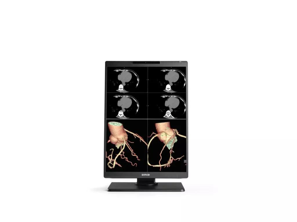 Barco MDNC‑2521 computer monitor 54.1 cm (21.3") 1600 x 1200 pixels LCD Black