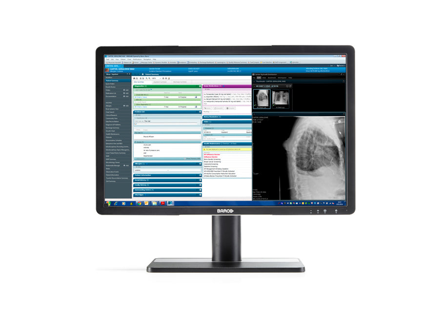 Barco MDRC-2222 computer monitor 54.6 cm (21.5") 1920 x 1080 pixels LCD Touchscreen Tabletop Black