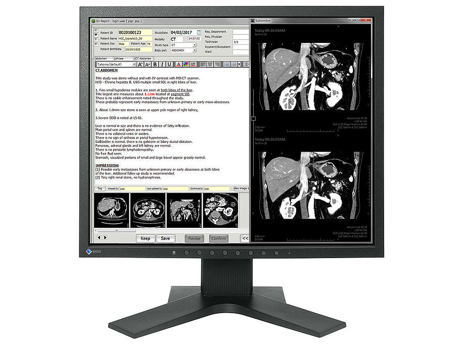 EIZO RadiForce MX194 computer monitor 48.3 cm (19") 1280 x 1024 pixels LCD Black