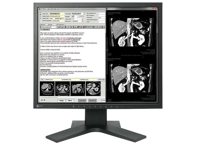 EIZO RadiForce MX194 computer monitor 48.3 cm (19") 1280 x 1024 pixels LCD Black