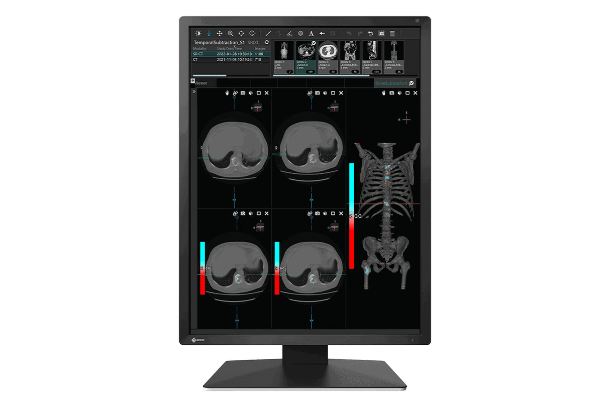 EIZO RadiForce MX217-BK computer monitor 54.1 cm (21.3") 1200 x 1600 pixels LCD Black