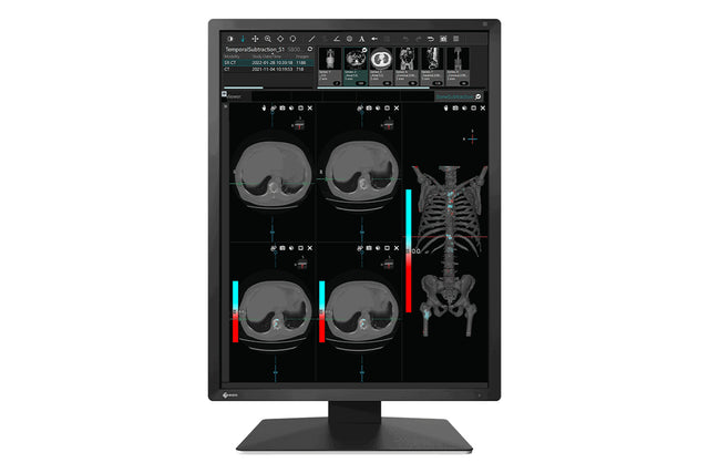 EIZO RadiForce MX217-BK computer monitor 54.1 cm (21.3") 1200 x 1600 pixels LCD Black