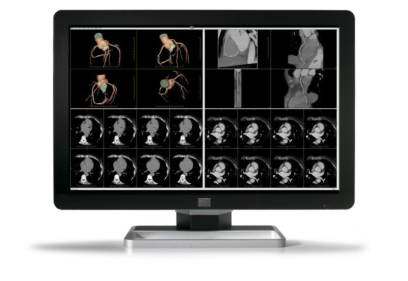 Barco MDCC-6430 computer monitor 77.2 cm (30.4") 3280 x 2048 pixels 4K Ultra HD LCD Black, Silver