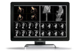 Barco MDCC-6430 computer monitor 77.2 cm (30.4") 3280 x 2048 pixels 4K Ultra HD LCD Black, Silver