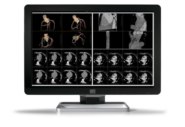 Barco MDCC-6430 computer monitor 77.2 cm (30.4") 3280 x 2048 pixels 4K Ultra HD LCD Black, Silver