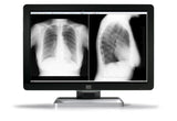 Barco MDCC-6430 computer monitor 77.2 cm (30.4") 3280 x 2048 pixels 4K Ultra HD LCD Black, Silver