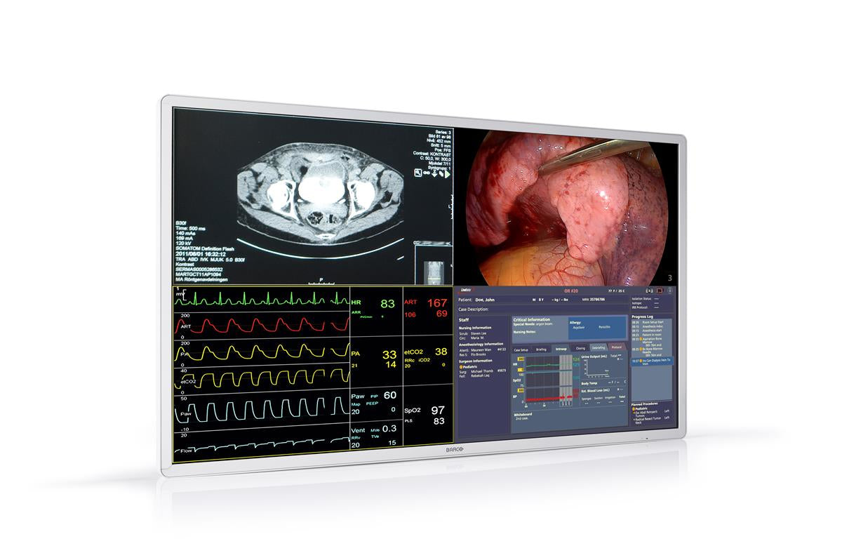 Barco MDSC-8255 computer monitor 139.7 cm (55") 3840 x 2160 pixels 4K Ultra HD LCD White