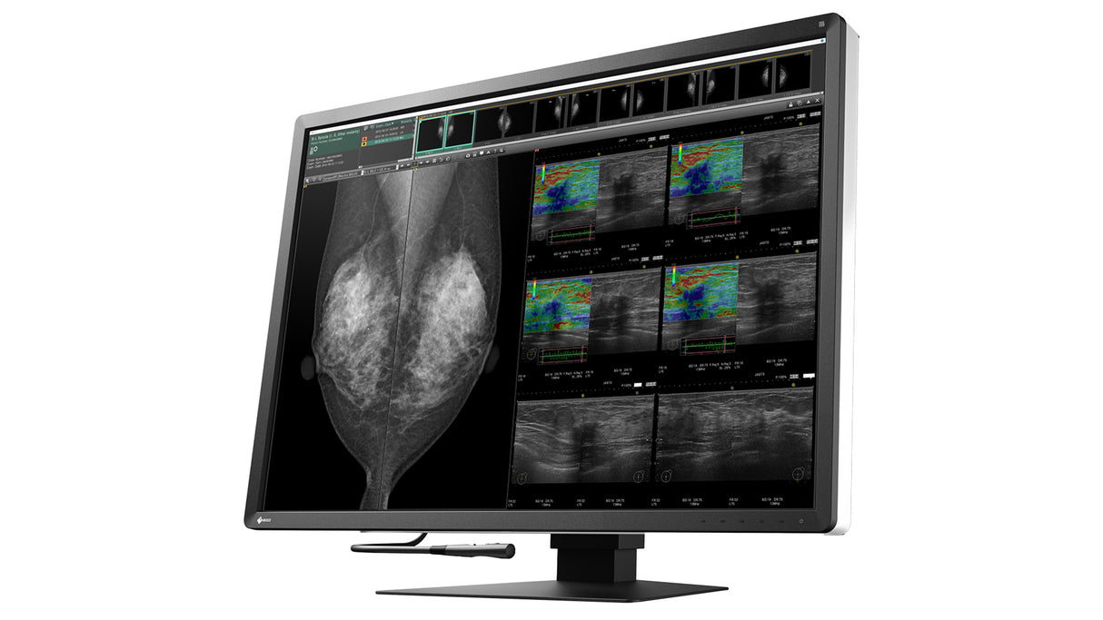 EIZO RadiForce RX1270 computer monitor 78.7 cm (31") 4200 x 2800 pixels LCD Black, White