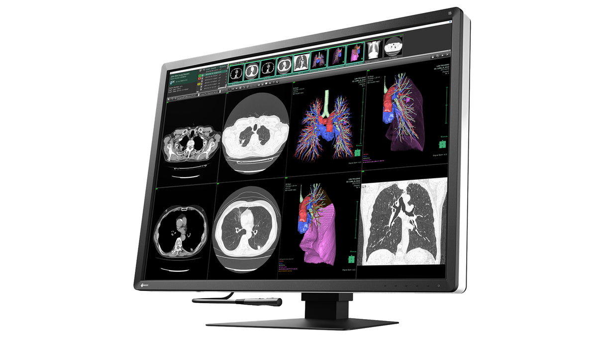 EIZO RadiForce RX1270 computer monitor 78.7 cm (31") 4200 x 2800 pixels LCD Black, White