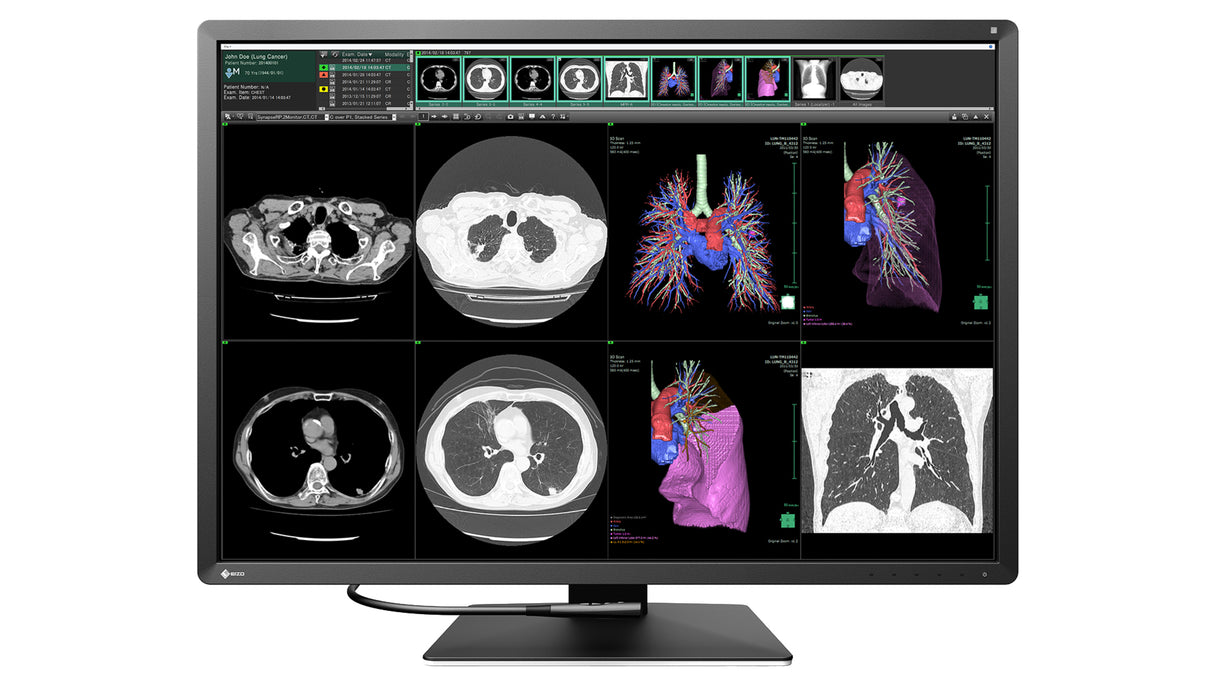 EIZO RadiForce RX1270 computer monitor 78.7 cm (31") 4200 x 2800 pixels LCD Black, White