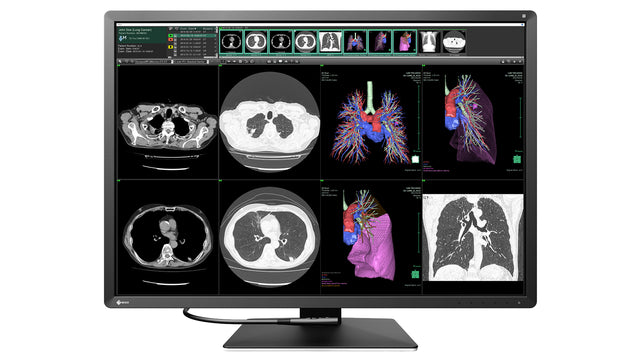 EIZO RadiForce RX1270 computer monitor 78.7 cm (31") 4200 x 2800 pixels LCD Black, White
