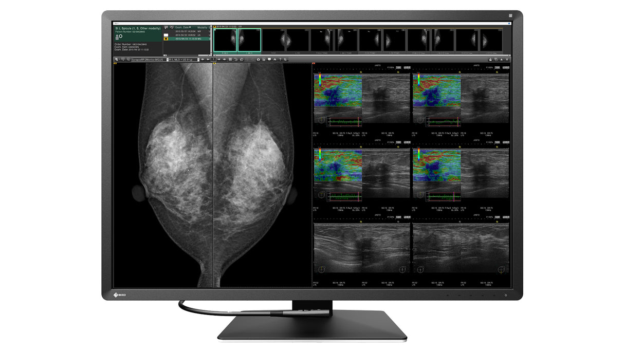 EIZO RadiForce RX1270 computer monitor 78.7 cm (31") 4200 x 2800 pixels LCD Black, White