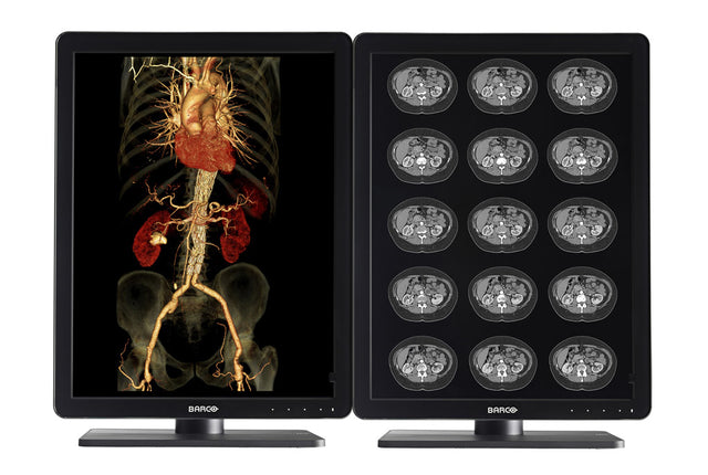 Barco MDNC-3421 computer monitor 54.1 cm (21.3") 2048 x 1536 pixels QXGA LCD Black, Silver