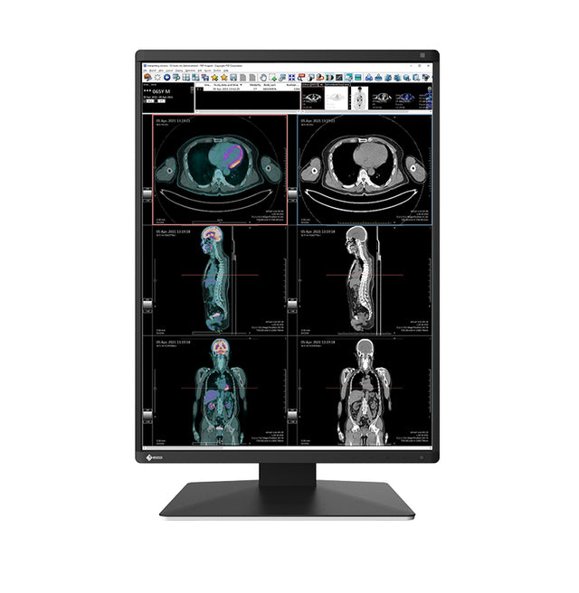 EIZO RadiForce RX370 computer monitor 54.1 cm (21.3") 1536 x 2048 pixels LCD Black