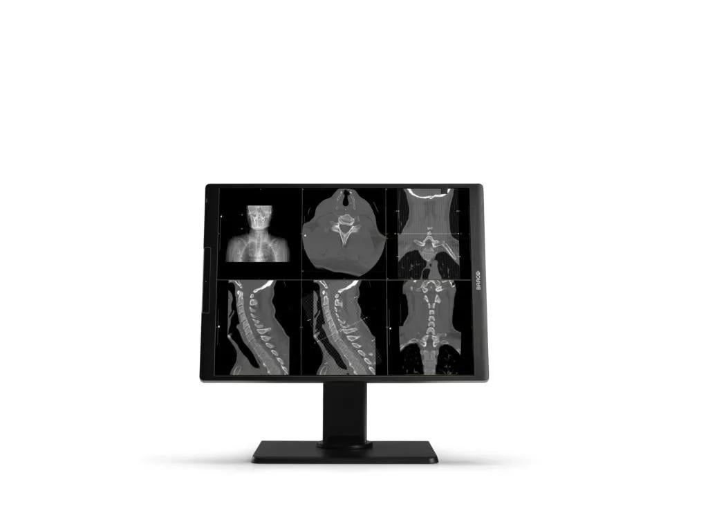 Barco MDNC‑2521 computer monitor 54.1 cm (21.3") 1600 x 1200 pixels LCD Black